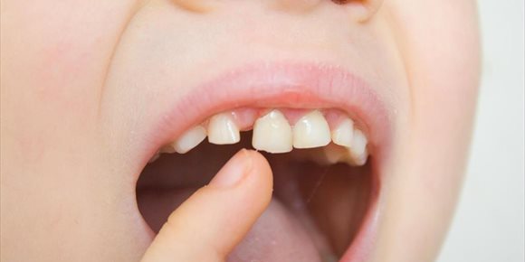 6. Unos dientes de leche sanos aseguran una buena salud bucodental en la adolescencia