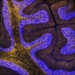 Archivo - Esta imagen muestra una sección delgada tomada del cerebelo de un cerebro de hurón adulto, con astrocitos marcados en amarillo y núcleos celulares marcados en azul