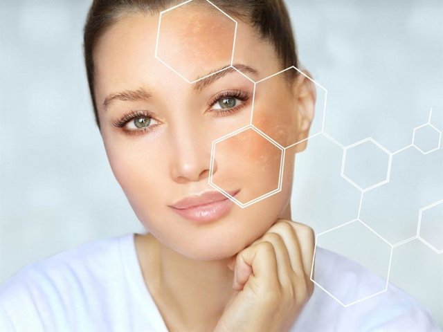 Tras el verano es el momento de luchar contra las manchas solares