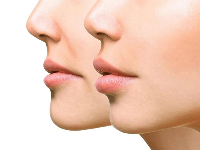 Combatir las arrugas del código de barras es ahora más sencillo que nunca