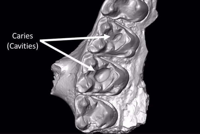 Parte del maxilar superior de Microsyops latidens con dos caries (cavidades).