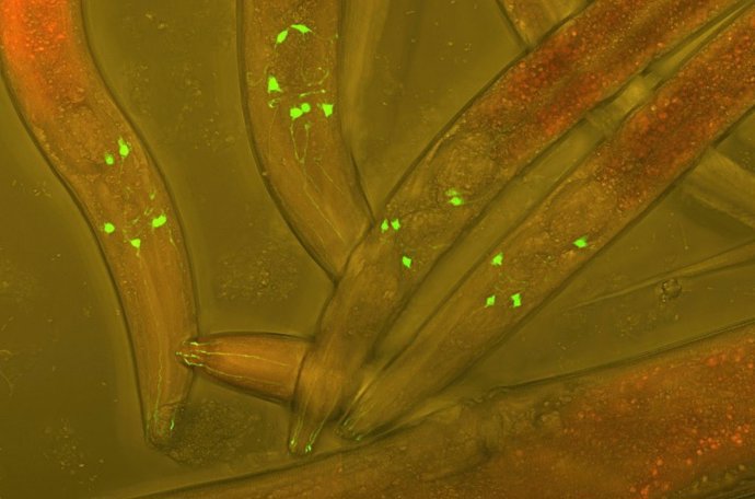 Gusanos C. Elegans con proteína verde fluorescente (GFP) insertada en sus neuronas para visualizar el desarrollo neuronal.