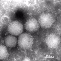 El virus Yezo, un tipo de nairovirus que se transmite entre animales y humanos a través de las garrapatas y causa fiebre y otros síntomas en los humanos.