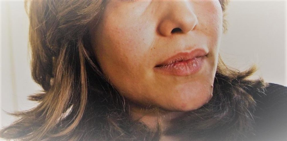 Mujer víctima de trata