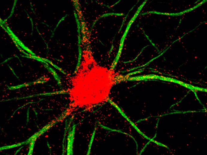 Archivo - Tinción para eEF1A2 (rojo) en neuronas del hipocampo de ratones.