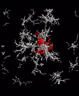 Archivo - Una placa de beta amiloide de núcleo denso (rojo) rodeada de microglía que carece de receptores TAM (blanco) en el cerebro de un ratón con enfermedad de Alzheimer.