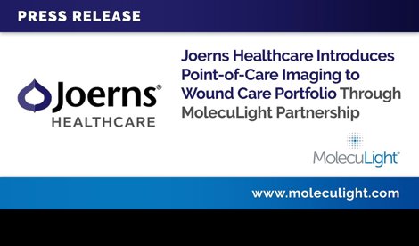 Comunicados Internacional