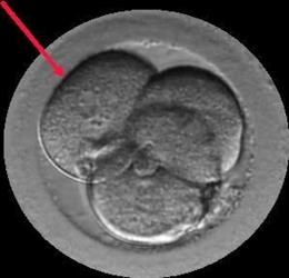 Embrión Multinucleado.