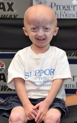 Archivo - Progeria Research Foundation