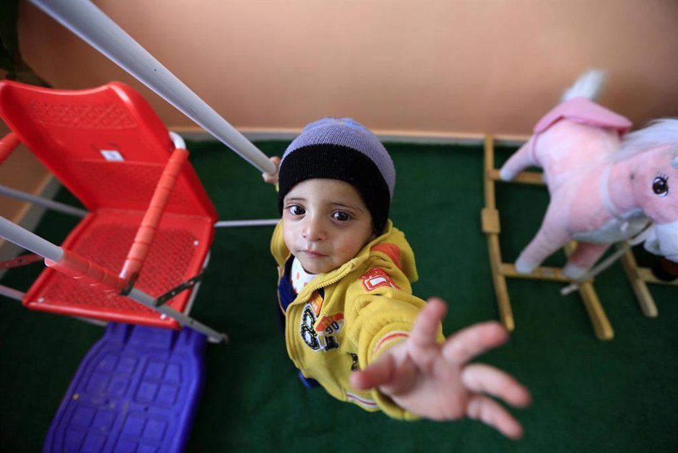 Archivo - Imagen de archivo de un niño atendido por Unicef en Yemen