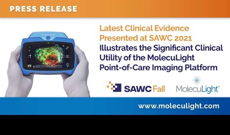 Comunicados Internacional