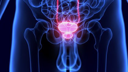 cancer de prostata agresivo esperanza de vida