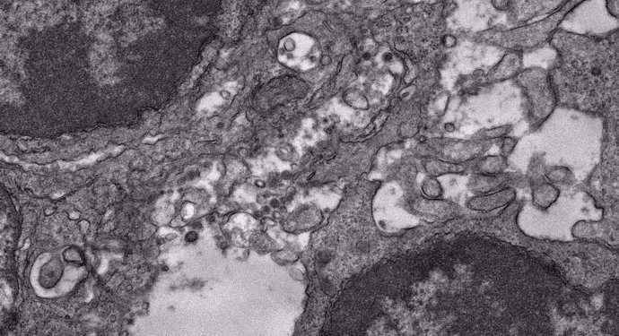 Imagen de microscopía electrónica del tejido de un ganglio linfático de un ratón que fue inmunizado con esta vacuna experimental contra la COVID-19.