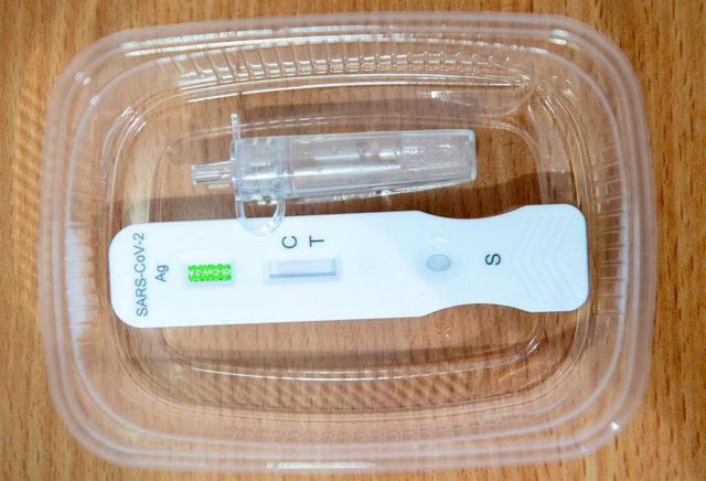 Archivo - Test de antígenos (archivo)