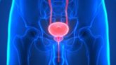 Foto: Identificada una nueva estrategia contra el cáncer de próstata resistente al tratamiento