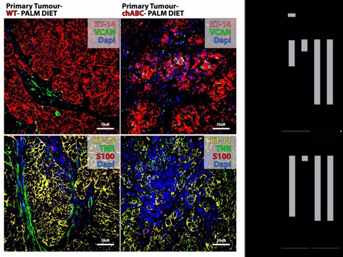 Las células de Schwann asociadas a tumores primarios con memoria palmítica segregan una matriz extracelular especializada pro regenerativa que recuerda a redes perineuronales.