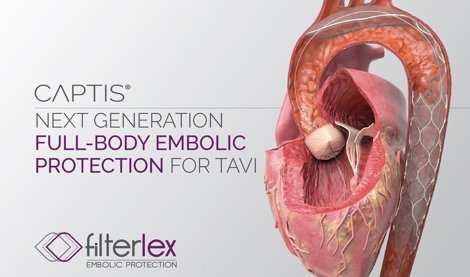 Comunicados Internacional