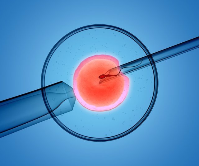 Archivo - 3D rendering of the icsi(intracytoplasmic sperm injection) process - in which a single sperm is injected directly into an egg