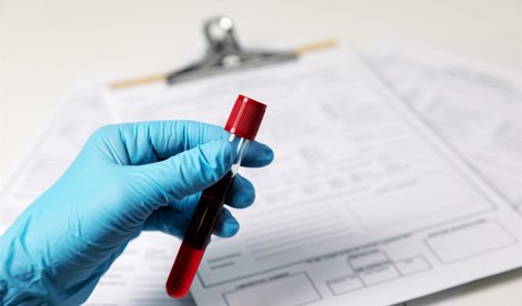 Comunicados Internacional