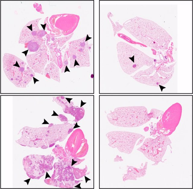 En comparación con un control (paneles de la izquierda), el tratamiento con C26 (paneles de la derecha) reduce el número de tumores metastásicos en los pulmones de ratones inyectados con células escamosas de cabeza y cuello.