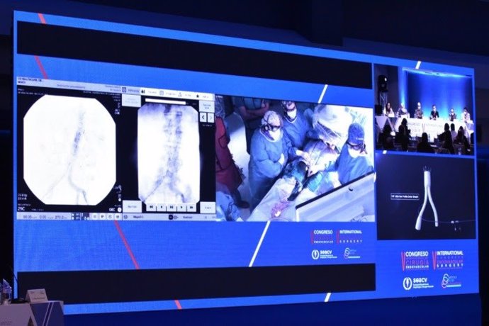 Imagen de una de las retransmisiones de casos en vivo desde varios hospitales nacionales e internacionales durante el Congreso