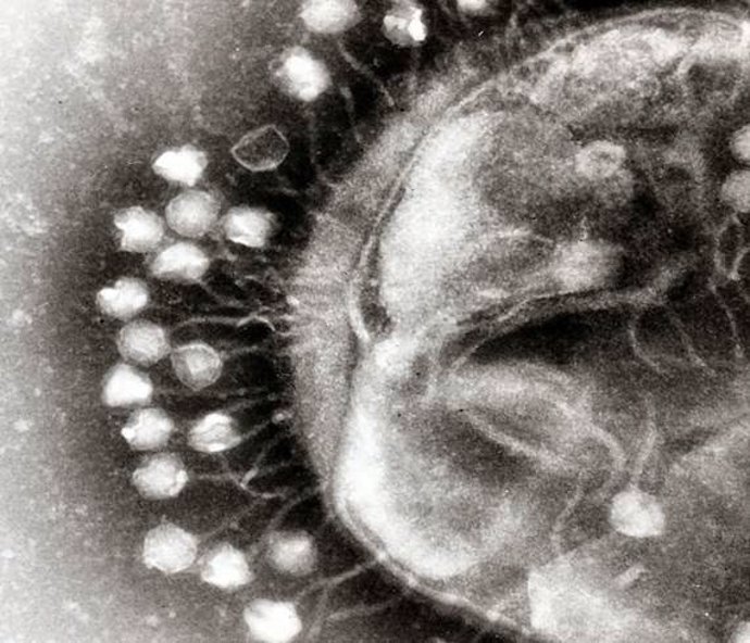 Archivo - Imagen de microscopía electrónica que muestra un grupo de virus bacteriófagos acoplados en una célula bacteriana.