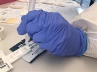 Extremadura supera los 100 casos a los 14 días aunque se mantiene con la incidencia más baja del país