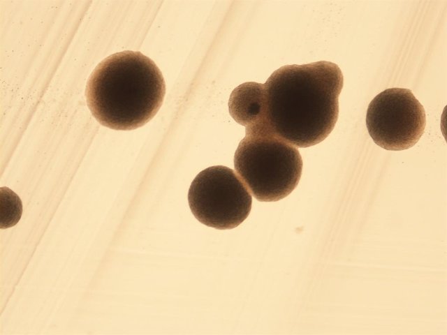 Foto al microscopio de una colonia de Saccharomyces uvarum.