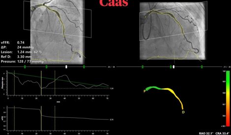 Comunicados Internacional