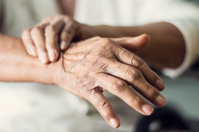 Archivo - Close up hands of senior elderly woman patient suffering from pakinson's desease symptom. Mental health and elderly care concept