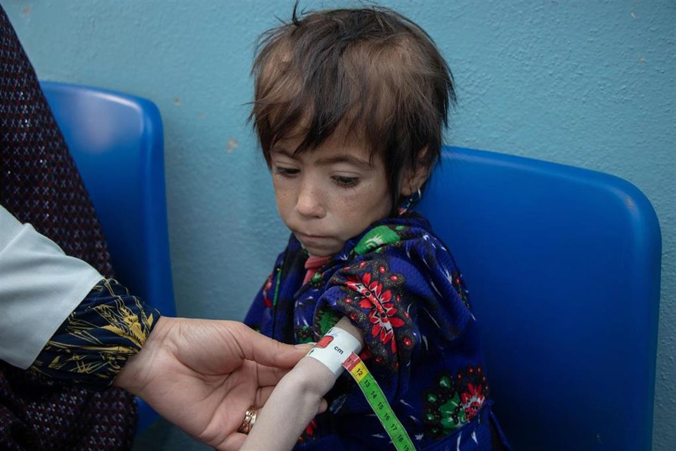 Archivo - Parwana es atendida en un hospital apoyado por UNICEF en Herat