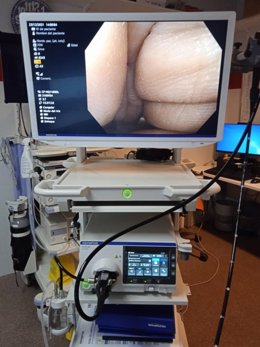 Nuevos equipos de endoscopia para implantar el programa de cribado de cáncer de colon.