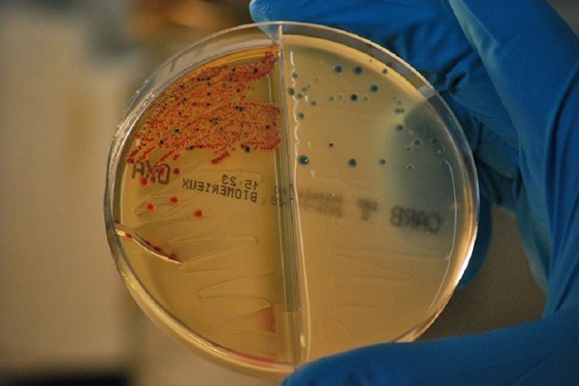 Archivo - Bacterias resistentes a los antibióticos aisladas en el IRYCIS. /