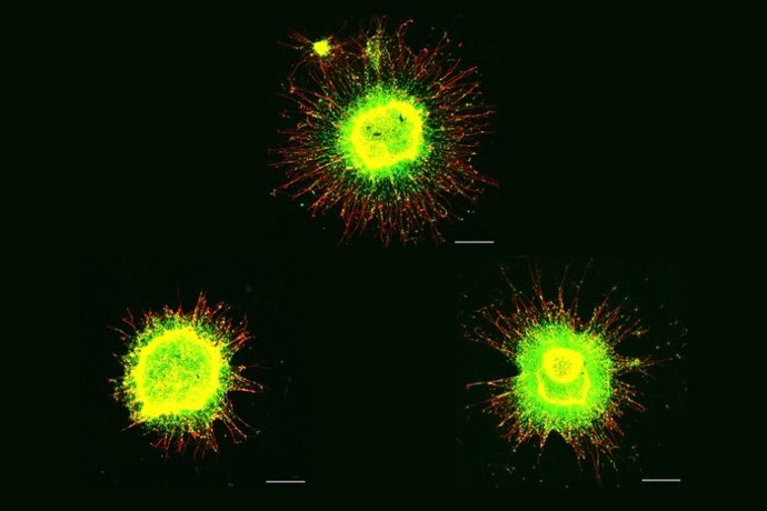 Migración de células progenitoras neuronales .