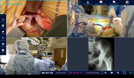 Comunicados Internacional