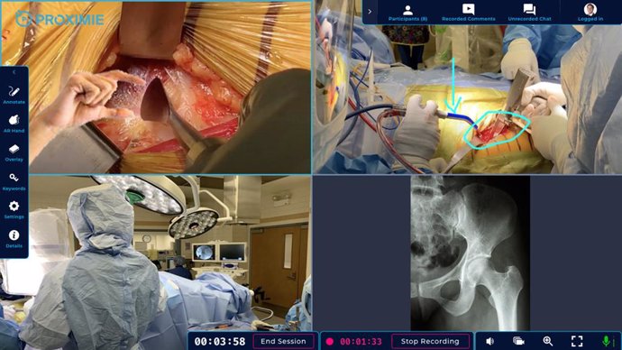 Proximies platform in action, with surgeons virtually scrubbing in to guide hip surgery