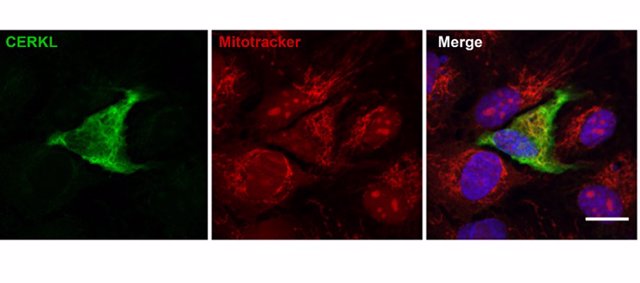 Explicación de la figura: CERKL (en verde) colocaliza con las mitocondrias (en rojo) en líneas celulares de epitelio pigmentario de retina (RPE) transfectadas con CERKL-GFP.