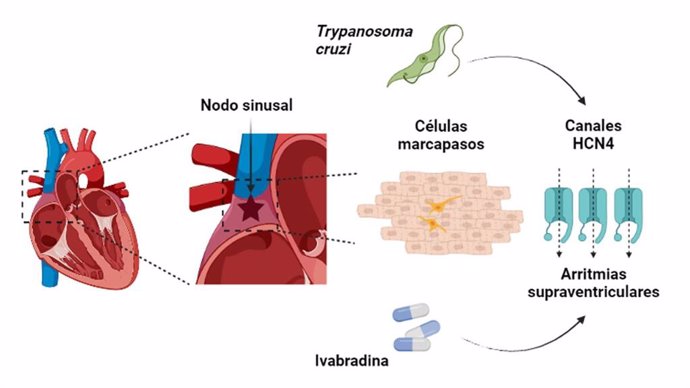 En la imagen se muestra la ubicación del nodo sinusal en el corazón y la morfología de las CM en el tejido cardiaco. La infección por T. Cruzi aumenta la expresión de los canales HCN4 de las CM.