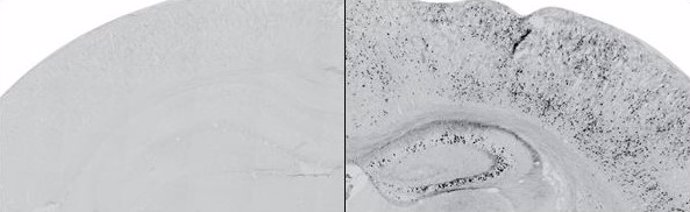Acumulación experimental del fragmento de la proteína neurexina en el modelo animal (en negro, panel derecho), respecto a ratones control (panel izquierdo)