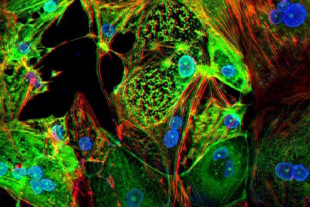 Archivo - Esta imagen del tejido cardíaco diseñado muestra células de músculo cardíaco humano (rojo) infectadas con el SARS-CoV-2 (verde).