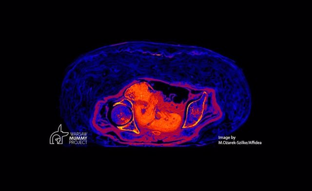 Imagen CT del feto presevado en una momia egipcia