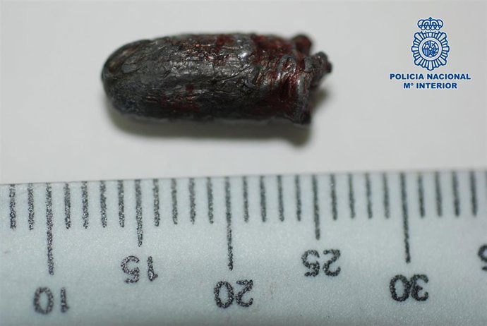 Proyecctil extraído a la víctima de La Peraleda.