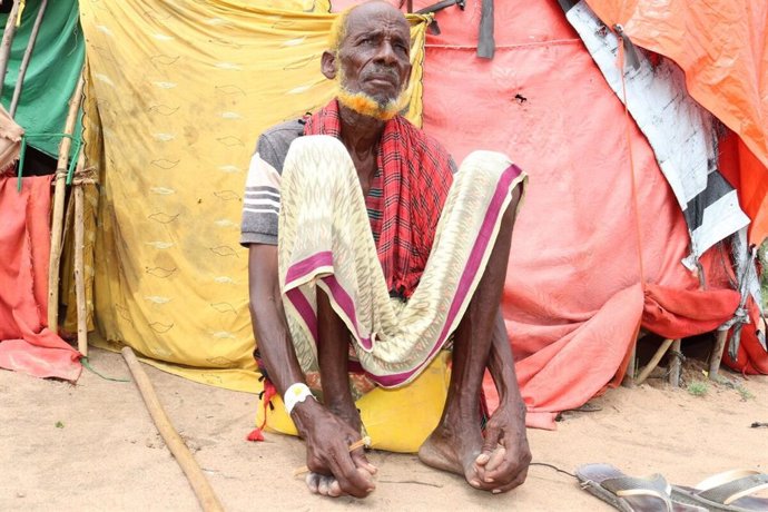 Un hombre afectado por las sequías en Somalia