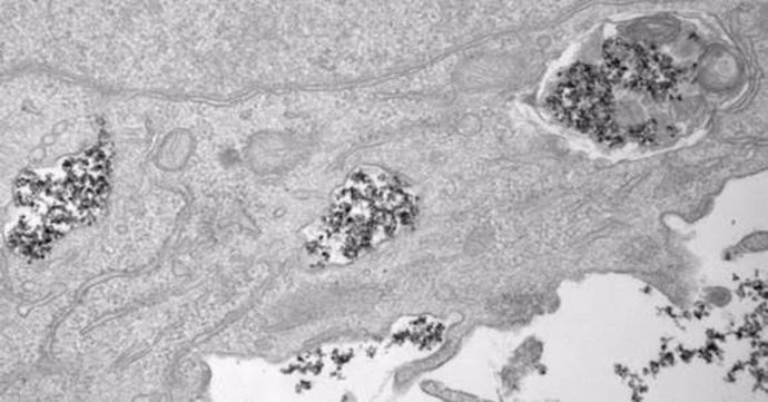 Nanopartículas de óxido de hierro en el interior de vesículas celulares en una imagen tomada con un microscopio electrónico de transmisión (TEM).