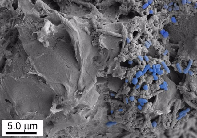 Imagen microscópica de microplásticos colonizados por la microbiota intestinal.