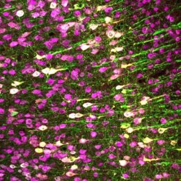 Neuronas (magenta) en el cerebro del ratón. El laboratorio hizo que neuronas específicas expresaran TRPA1 (blanco), para que pudieran ser activadas por los ultrasonidos.