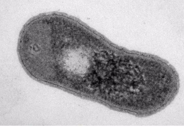 Imagen TEM de la bacteria Gemmatimonas phototrophica