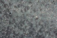 El cambio climático y sus cambios de temperatura extremos tendrán efectos complejos en la transmisión de enfermedades