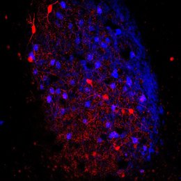 Imagen de la amígdala basolateral de un ratón Thy1 en que se pueden observar las neuronas excitadoras (de color azul) y las neuronas inhibidoras PV+ (de color rojo).