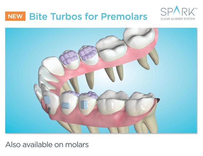Spark Release 12 - Posterior Bite Turbos (PRNewsFoto/Ormco Corporation)